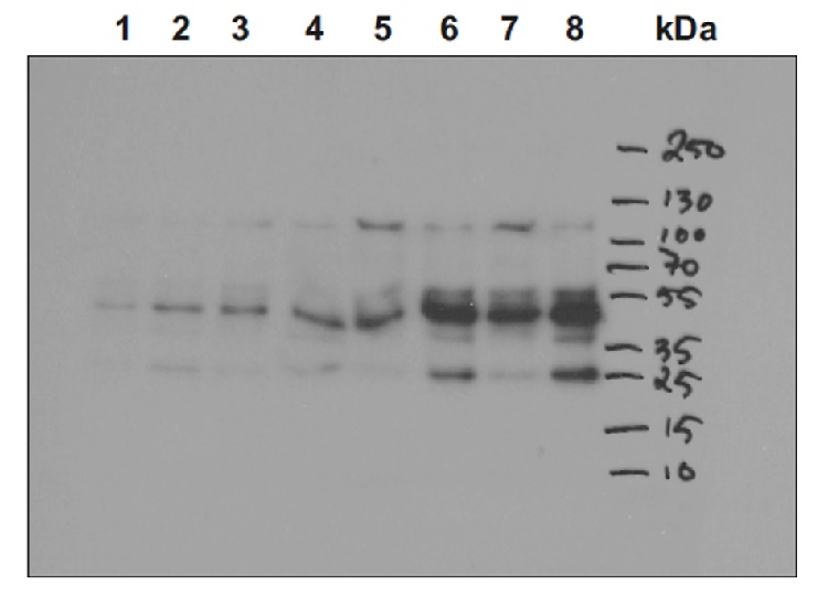 Western blot using anti-CP43' antibodies