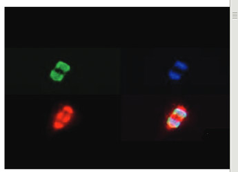 immunofluorescence using anti-H3K27me3S28p | Histone H3 (trimethylated Lys27, p Ser28) polyclonal antibodies
