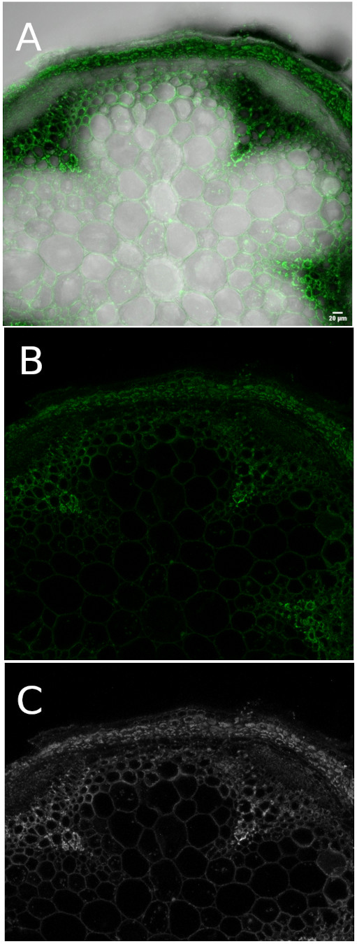 Immunofluorescence using anti-heteromannan antibodies