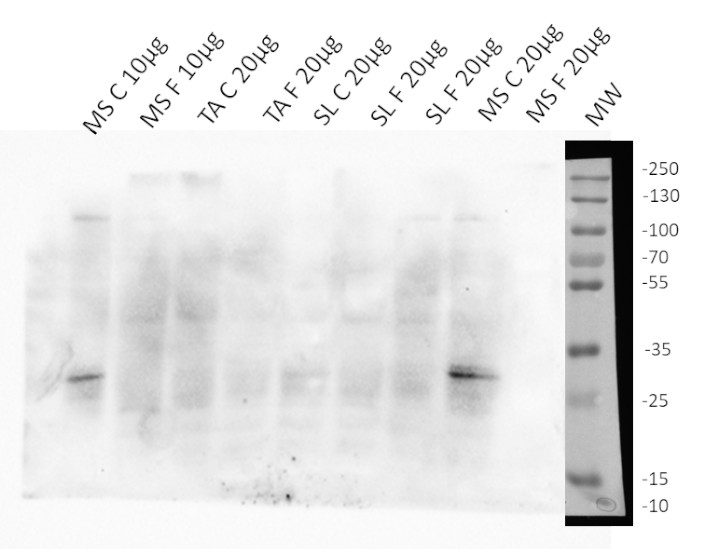 Western blot using anti plant AHB1 antibodies