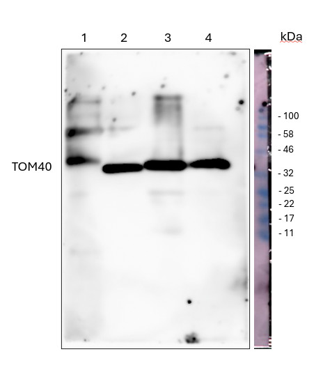 Western blot using anti-TOM40-1/2 antibodies