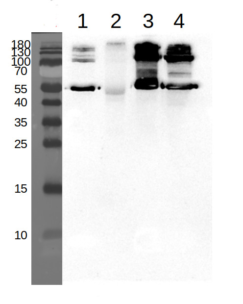 Western blot using anti-SHMT1 antibodies