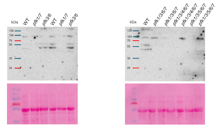 Western blot using anti-phosphofructokinase antibodies