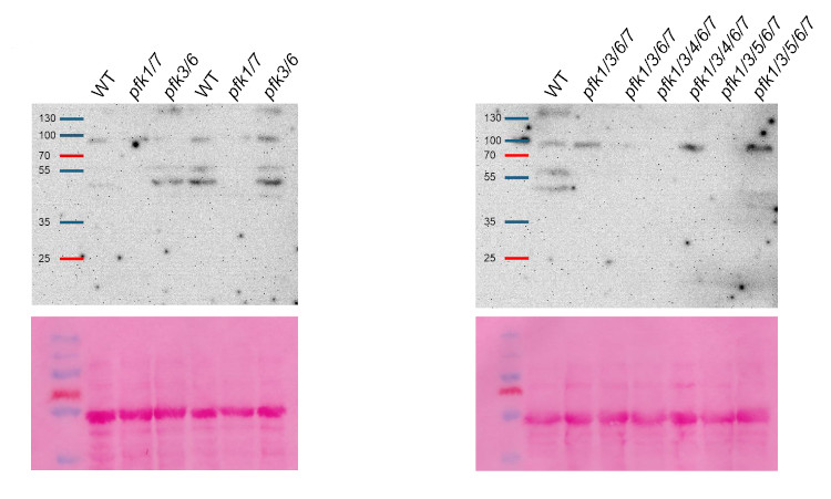 Western blot using anti-phosphofructokinase antibodies