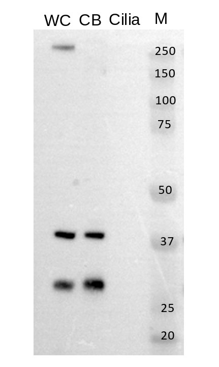 Western blot using anti-NAB1 antibodies