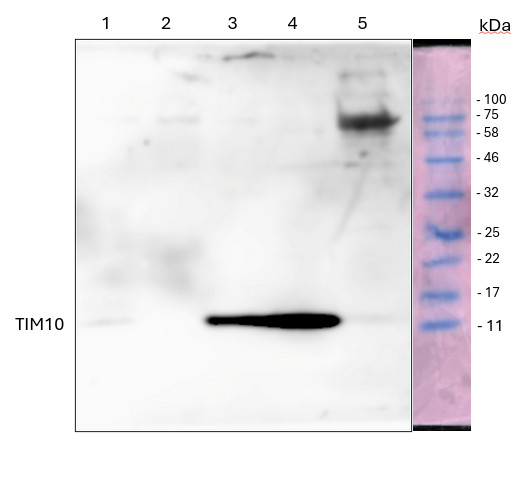 Western blot using anti-TIM10 antibodies