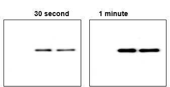 Western blot using anti-SUMO tag antibodies