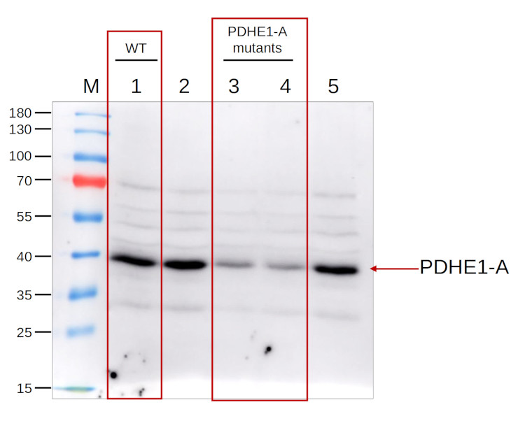 Western blot using anti-PDHE1-A antibodies