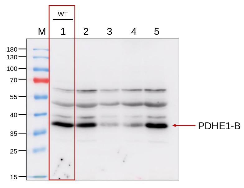 Western blot using anti-PDHE1-B antibodies